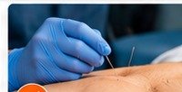 Dry needling therapy treatment